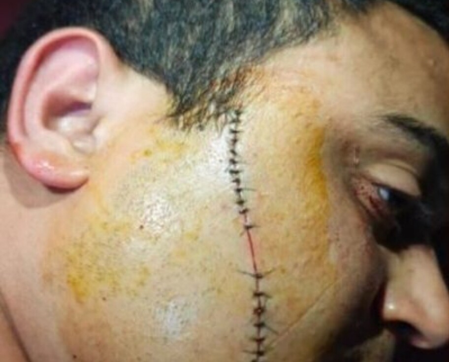 مرصد حقوقي يستنكر الاعتداء البشع بـ”زيزوار” على دكتور بجامعة وجدة