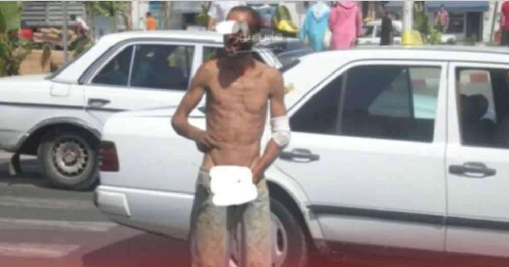 برلماني يطالب وزير الداخلية الكشف عن أسباب إغراق تازة بالمجانين والمشردين