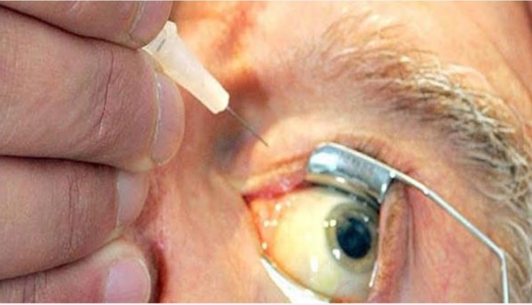 الفرقة الوطنية تستمع للمصابين بالعمى بمستشفى 20 غشت بالدار البيضاء بعد حقنهم بإبر مسمومة !