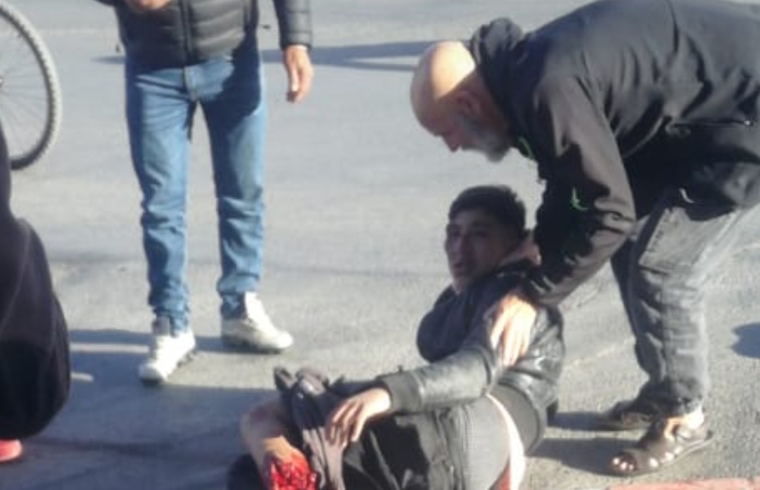 فيديو + 16 :    حادث سير مروع وسط وجدة يتسبب في بتر ساق شاب وإلتصاقه بمقدمة السيارة