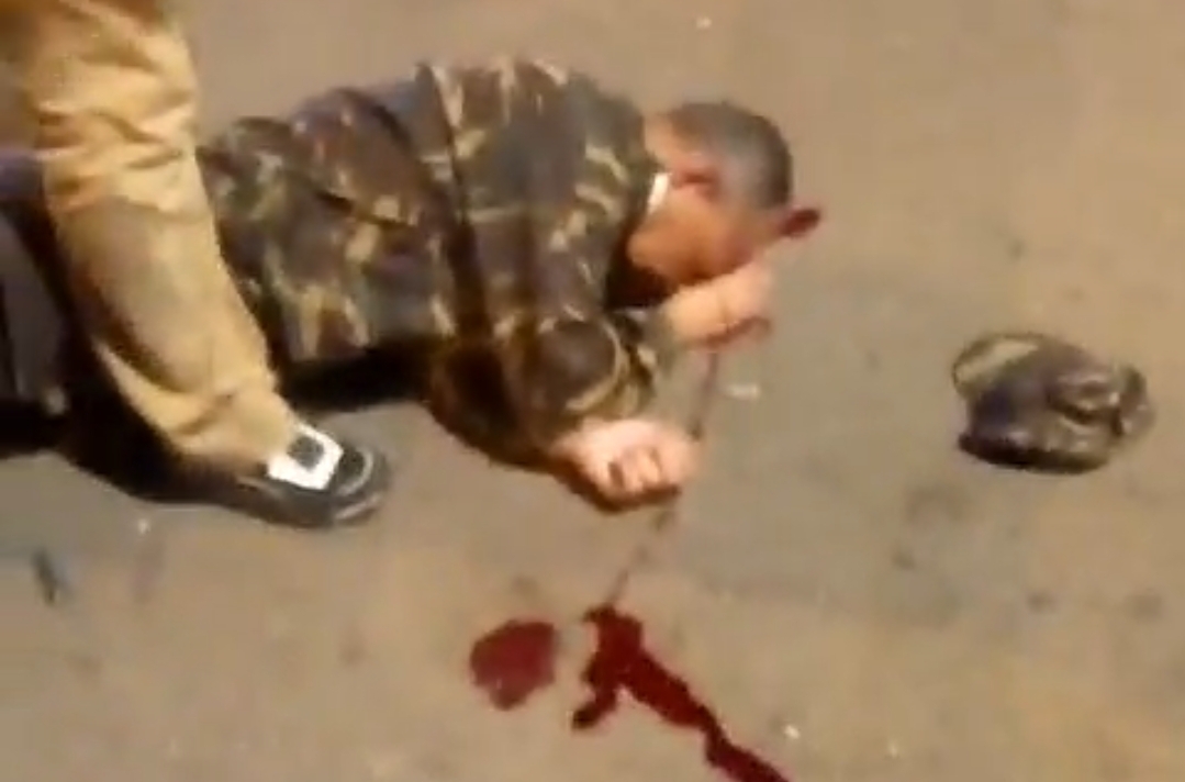 كسر رأس خليفة قائد بالدار البيضاء من طرف بائع متجول شعر ب “الحكرة”