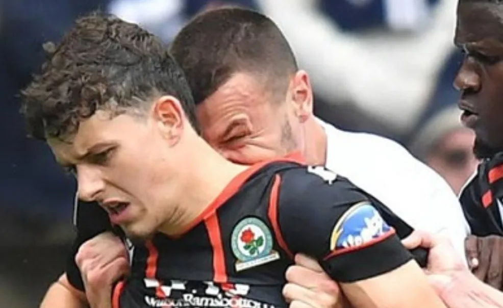 إيقاف لاعب بالدوري الإنجليزي بعد إلتهامه لجزء من جسد مدافع بلاكبيرن