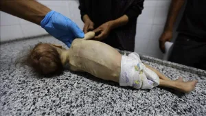 الجوع بدأ يلتهم 650 ألف طفل في غزة