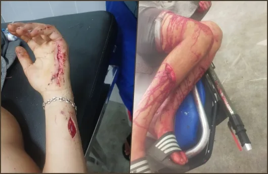 هجوم دموي على محل لبيع الفطائر … عصابة مسلحة تثير الرعب في الجديدة