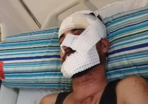 الحسبمة :     حادثة مأساوية ببني بوعياش تفضح هشاشة البنية التحتية وعجز المركز الاستشفائي بأجدير