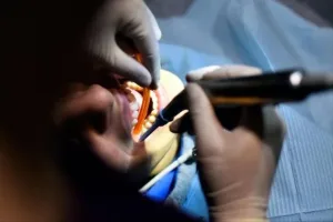 المغرب ينمو كوجهة رائدة للسياحة العلاجية في طب الأسنان