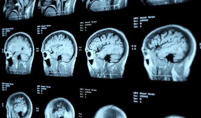 “كل دقيقة لها أهميتها”… المغرب يطلق حملة وطنية للوقاية من السكتة الدماغية