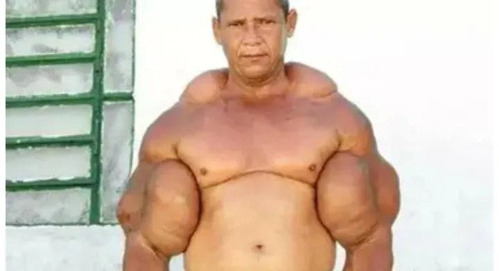 مأساة “بوباي البرازيلي”: وفاة أسطورة كمال الأجسام بعد حقن نفسه بالزيت وارتفاع قياس عضلاته إلى 73 سنتيمتراً