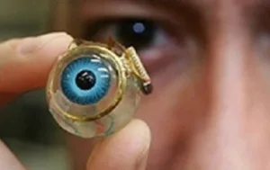 ألمانيا :      مغربي من الناظور يطلق نداء استغاثة :  زرعوا داخل جسمه أجهزة غريبة و “حوّلوه إلى فأر تجارب” … والدولة تلتزم الصمت !!