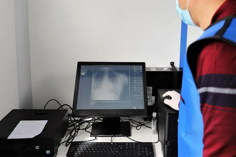 السل في المغرب.. تحذيرات من أزمة صحية تغذيها الهشاشة ونواقص العلاج