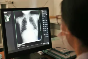 أشكال السل خارج الرئة تمثل أكثر من نصف الحالات الجديدة بالمغرب