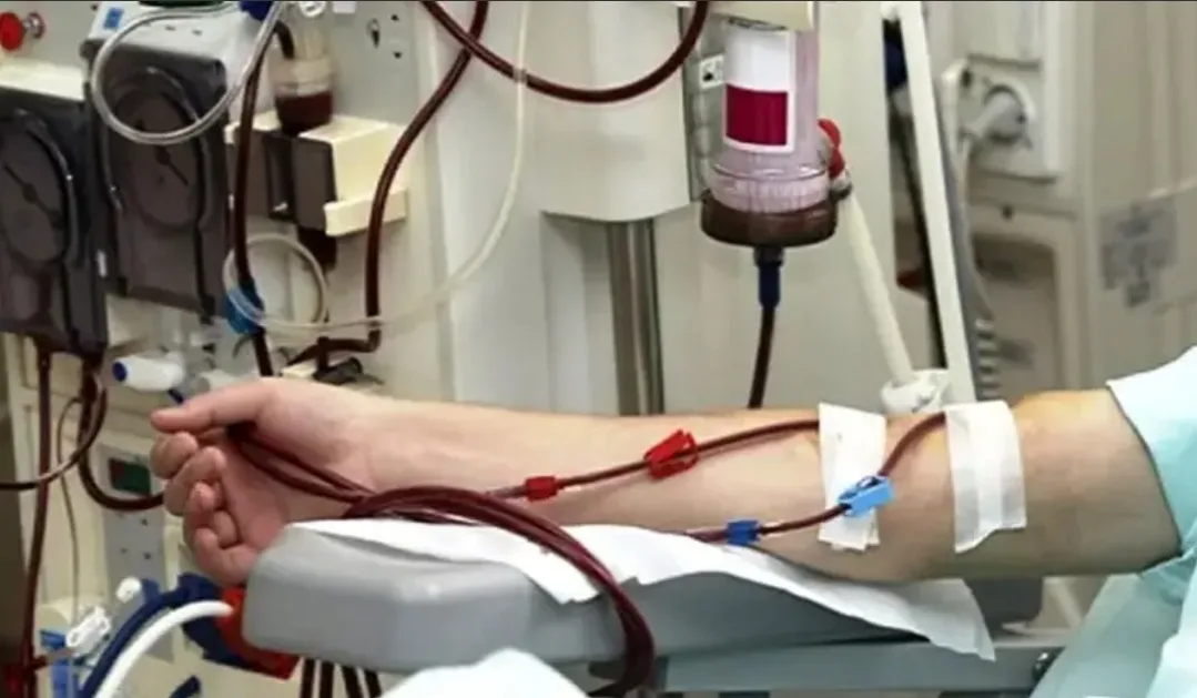 جدل في الحسيمة :     اتهامات بالإتجار في المرضى من طرف جمعية بترجيست بعد تدشين حافلة لنقل مرضى القصور الكلوي بكتامة