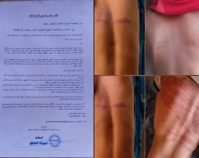 جمعية حقوقية تطالب بتدخل عاجل لمواكبة ملف اعتداء على أطفال بزاكورة